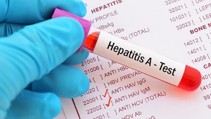 Las 5 hepatitis virales, conoce cu&aacute;les son y sus s&iacute;ntomas