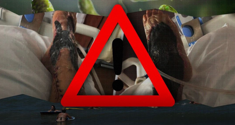 Alerta en EE.UU por presencia de mortal bacteria comecarne en aguas del Atl&aacute;ntico 