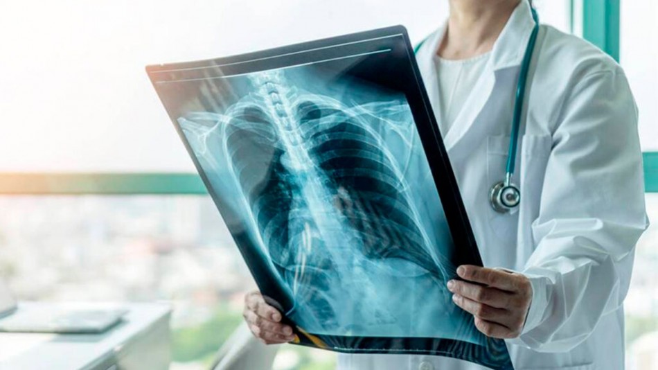 Ministerio de Salud P&uacute;blica afirma que no hay riesgo de brote de tuberculosis en el pa&iacute;s