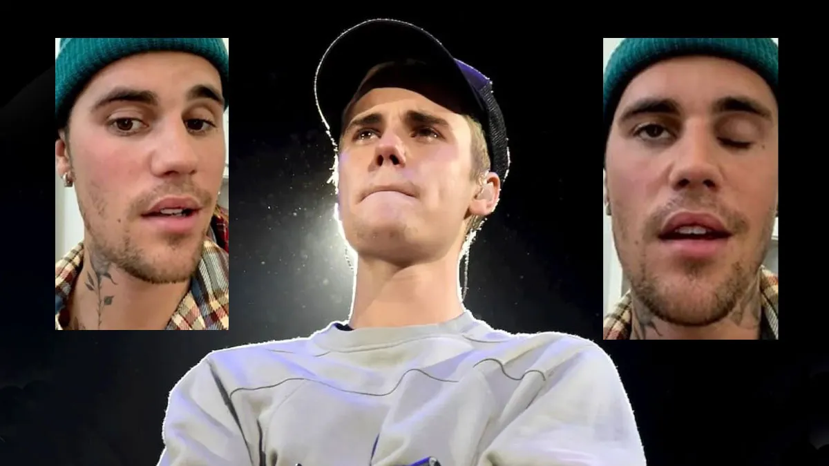 Justin Bieber sufri&oacute; una par&aacute;lisis facial
