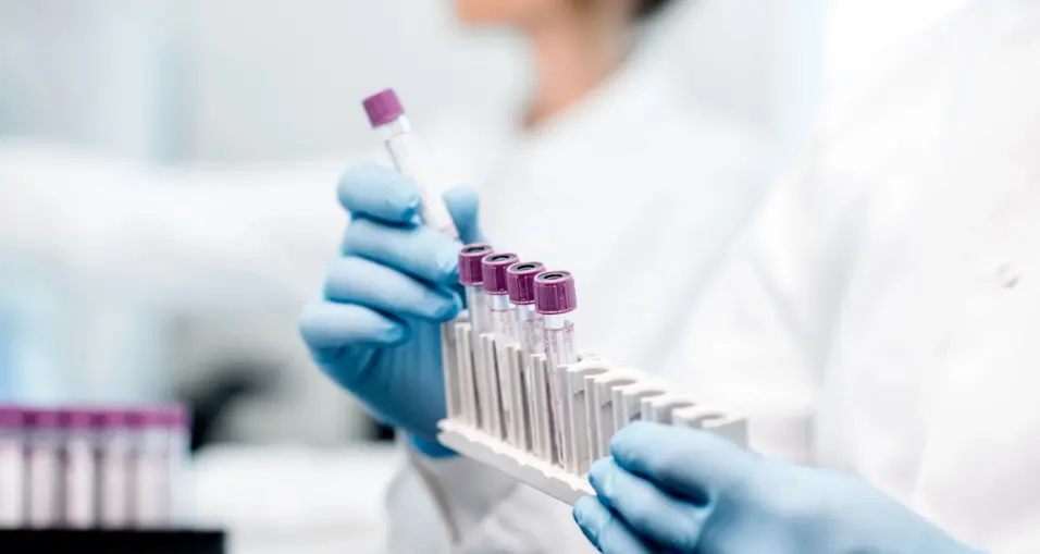 Decenas de personas infectadas en China con nuevo virus Langya