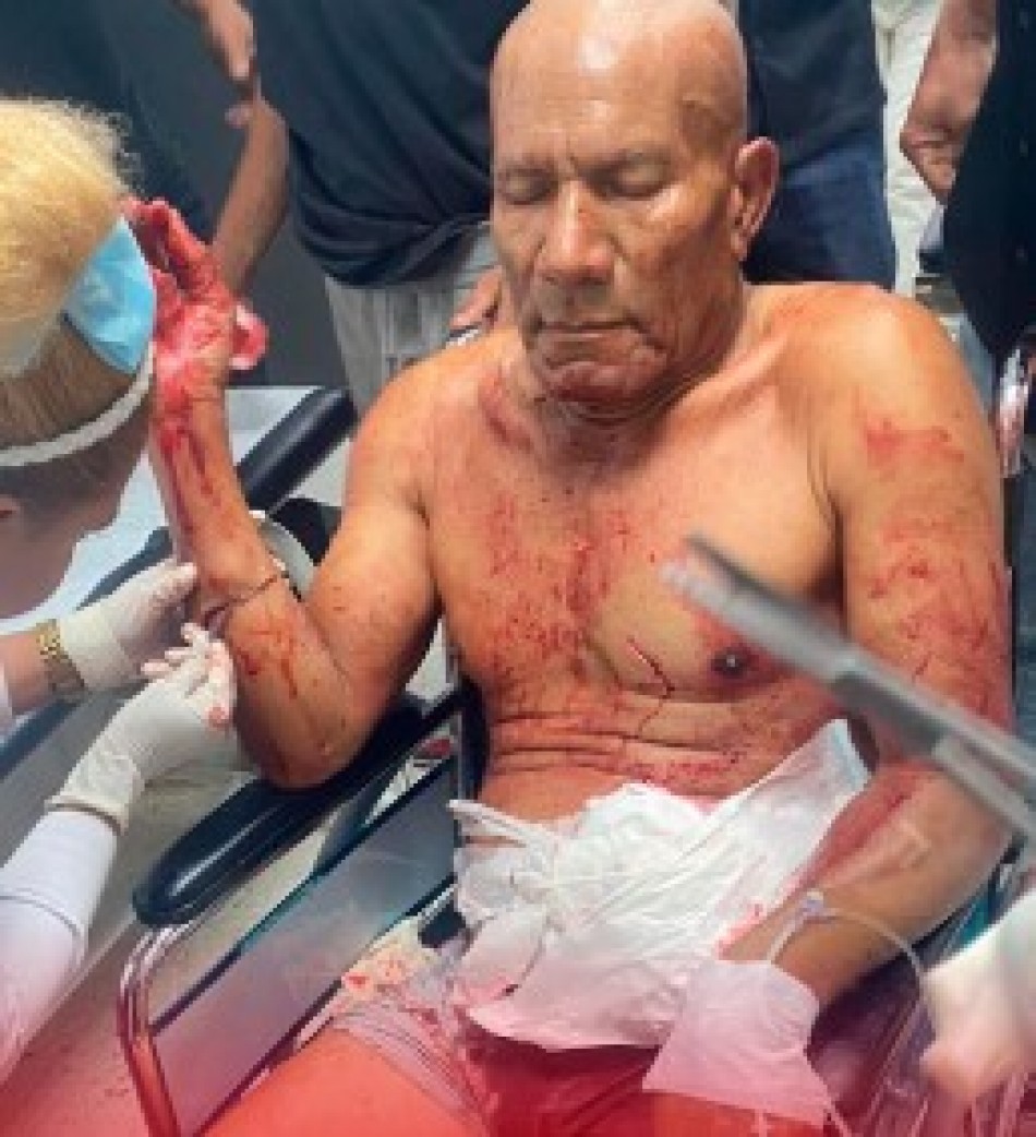 Ex teniente de la policia nacional es brutalmente atacado en su hogar por ciudadanos haitianos