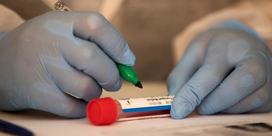 Salud Pública establece el boletín #972 durante los contagios del Covid-19