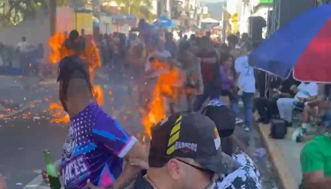 Fallece uno de los ni&ntilde;o que result&oacute; quemado en el Carnaval de Salcedo