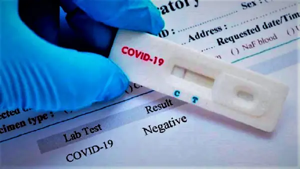 En el pa&iacute;s hay 206 casos activos de Covid-19