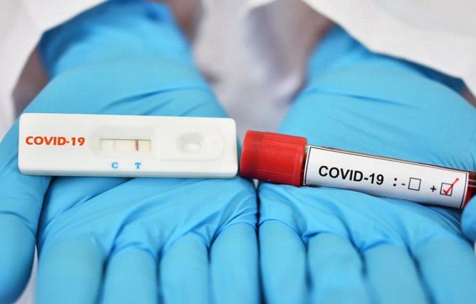 Salud Pública reporta 25 nuevos contagios de COVID-19
