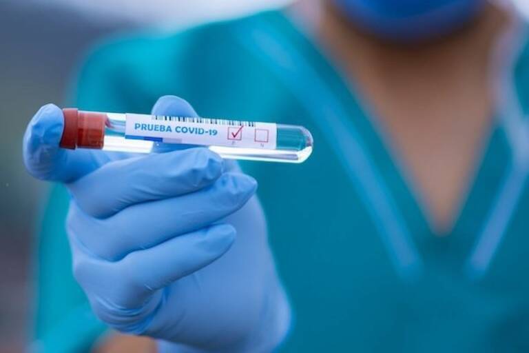 Contagios de Covid  sube a 1,920  durante este a&ntilde;o
