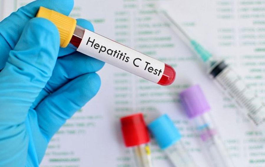 OMS dice que al menos un ni&ntilde;o muri&oacute; tras aumento de casos de hepatitis aguda infantil