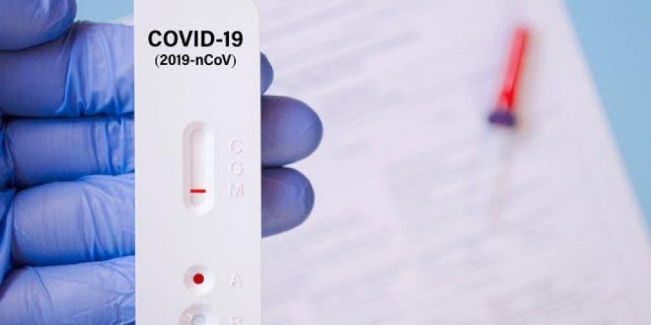 República Dominicana registra 341 casos activos de COVID-19
