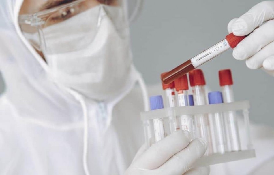 Salud Pública reporta 409 nuevos contagios de COVID-19