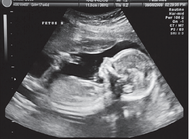 El derecho al aborto, protagonista clave de las elecciones en Pensilvania